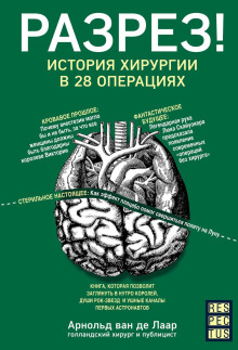 Разрез! История хирургии в 28 операциях