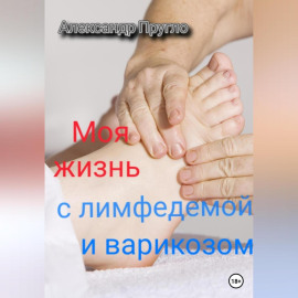 Моя жизнь с лимфедемой и варикозом