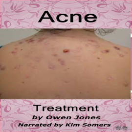 Acne Treatment